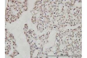 Image no. 5 for anti-DEAD (Asp-Glu-Ala-Asp) Box Polypeptide 54 (DDX54) (AA 778-882) antibody (ABIN599302) (DDX54 抗体  (AA 778-882))