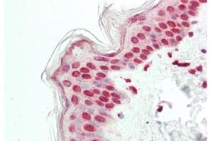 Immunohistochemistry (IHC) image for anti-E74-Like Factor 2 (Ets Domain Transcription Factor) (ELF2) (N-Term) antibody (ABIN2777387)
