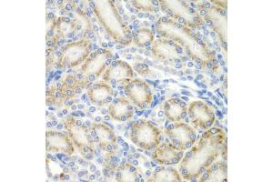 Immunohistochemistry of paraffin-embedded rat kidney using ASPSCR1 antibody (ABIN5975297) at dilution of 1/100 (40x lens). (ASPSCR1 抗体)