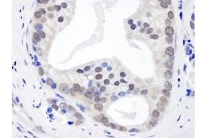 Immunohistochemistry (IHC) image for anti-Casein kappa (CSN3) (AA 325-375) antibody (ABIN7448493) (CSN3 抗体  (AA 325-375))