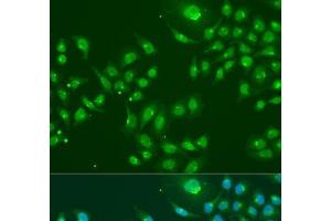 Immunofluorescence analysis of U2OS cells using IFIT3 Polyclonal Antibody at dilution of 1:100. (IFIT3 抗体)