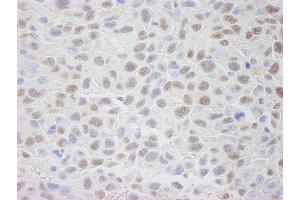 Immunohistochemistry (IHC) image for anti-Exportin 1 (XPO1) (C-Term) antibody (ABIN7448488)