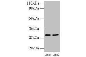 Western blot All lanes: RPL8 antibody at 2 μg/mL Lane 1: EC109 whole cell lysate Lane 2: 293T whole cell lysate Secondary Goat polyclonal to rabbit IgG at 1/10000 dilution Predicted band size: 29 kDa Observed band size: 29 kDa (RPL8 抗体  (AA 3-257))