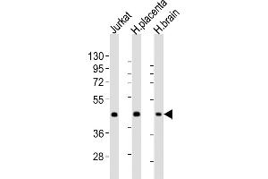 All lanes : Anti-WNT2 Antibody (Center) at 1:2000 dilution Lane 1: Jurkat whole cell lysates Lane 2: human placenta lysates Lane 3: human brain lysates Lysates/proteins at 20 μg per lane.