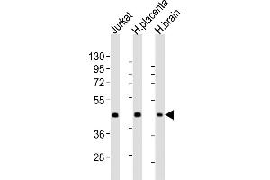 All lanes : Anti-WNT2 Antibody (Center) at 1:2000 dilution Lane 1: Jurkat whole cell lysates Lane 2: human placenta lysates Lane 3: human brain lysates Lysates/proteins at 20 μg per lane. (WNT2 抗体  (AA 254-287))
