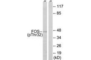 Western blot analysis of extracts from Jurkat cells treated with starved 24h, using FOS (Phospho-Ser32) Antibody. (c-FOS 抗体  (pSer32))