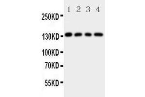 Western Blotting (WB) image for anti-Laminin, gamma 2 (LAMC2) (AA 1160-1180), (C-Term) antibody (ABIN3043156) (LAMC2 抗体  (C-Term))