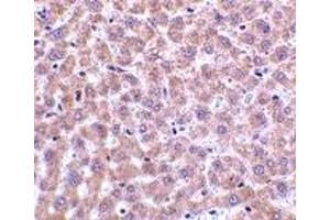 Immunohistochemistry (IHC) image for anti-Perilipin 3 (PLIN3) (N-Term) antibody (ABIN1031617) (PLIN3 抗体  (N-Term))