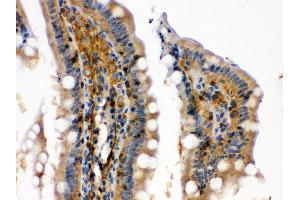 Anti- RAB13 Picoband antibody, IHC(P) IHC(P): Rat Intestine Tissue (RAB13 抗体  (C-Term))