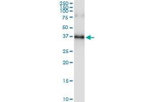 Immunoprecipitation (IP) image for anti-Sprouty Homolog 1, Antagonist of FGF Signaling (SPRY1) (AA 1-319) antibody (ABIN523662)