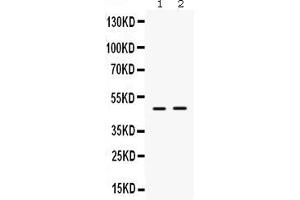 Western Blotting (WB) image for anti-Inhibitor of Growth Family, Member 1 (ING1) (AA 192-223), (Middle Region) antibody (ABIN3042467)