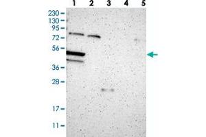 Western blot analysis of Lane 1: RT-4, Lane 2: U-251 MG, Lane 3: Human Plasma, Lane 4: Liver, Lane 5: Tonsil with TNRC4 polyclonal antibody  at 1:250-1:500 dilution. (CELF3 抗体)