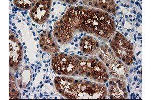 Image no. 1 for anti-Aminoacylase 3 (ACY3) antibody (ABIN1496464) (Aminoacylase 3 抗体)