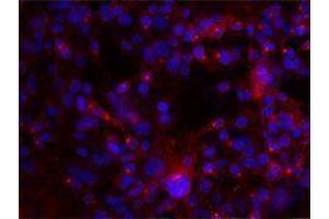 Immunofluorescence (IF) image for anti-Integrin AlphaV, Integrin Beta3 (ITGAV/ITGB3) antibody (ABIN2664760) (CD51/CD61 抗体)