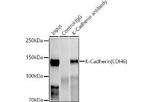 Immunoprecipitation analysis of 300 μg extracts of HepG2 cells using 3 μg K-Cadherin (CDH6) antibody (ABIN1680831, ABIN3019147, ABIN3019148 and ABIN7101722).