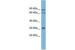 WB Suggested Anti-CUTC Antibody Titration: 0. (CUTC 抗体  (Middle Region))