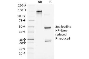 SDS-PAGE Analysis of Purified Beta-Catenin (p120) Monoclonal Antibody (5H10).