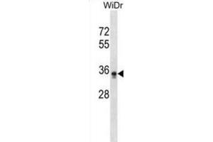 Western Blotting (WB) image for anti-Phosphatidylinositol Glycan L (PIGL) antibody (ABIN2999037) (PIGL 抗体)