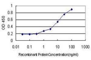 Detection limit for recombinant GST tagged DEF6 is approximately 1ng/ml as a capture antibody. (DEF6 抗体  (AA 1-336))