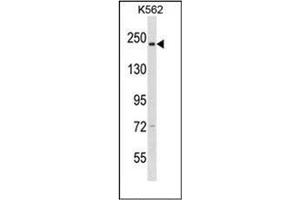 Western blot analysis of CAPD3 Antibody (C-term) in K562 cell line lysates (35ug/lane). (NCAPD3 抗体  (C-Term))