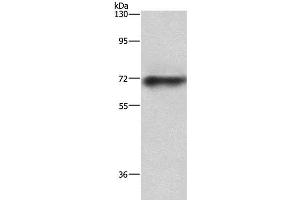 Western Blot analysis of Mouse heart tissue using ABCB8 Polyclonal Antibody at dilution of 1:750 (ABCB8 抗体)