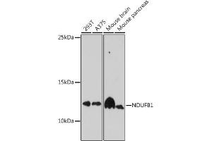 Western blot analysis of extracts of various cell lines, using NDUFB1 antibody (ABIN7268808) at 1:1000 dilution.