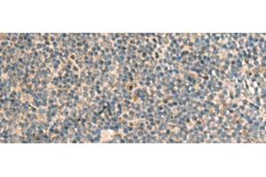Immunohistochemistry of paraffin-embedded Human tonsil tissue using POFUT1 Polyclonal Antibody at dilution of 1:50(x200) (POFUT1 抗体)