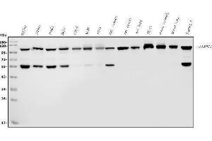 Western blot analysis of ANAPC2 using anti-ANAPC2 antibody (ABIN7601930).