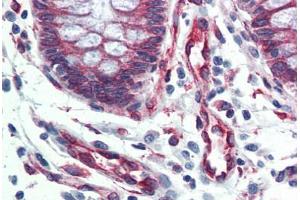 anti-Serpin Family H Member 1 (SERPINH1) antibody