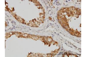 Immunoperoxidase of monoclonal antibody to MAPK13 on formalin-fixed paraffin-embedded human testis. (MAPK13 抗体  (AA 251-365))