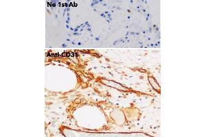 Immunohistochemistry (IHC) image for anti-Platelet/endothelial Cell Adhesion Molecule (PECAM1) (C-Term) antibody (ABIN6254202) (CD31 抗体  (C-Term))