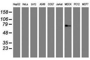 Image no. 2 for anti-Golgi Membrane Protein 1 (GOLM1) antibody (ABIN1498496) (GOLM1 抗体)