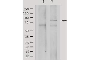 Western blot analysis of extracts from mouse brain, using GRK3 Antibody. (ADRBK2 抗体  (Internal Region))