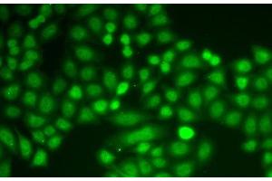 Immunofluorescence analysis of A549 cells using ASC / TMS1 Polyclonal Antibody (PYCARD 抗体)