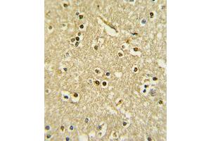 Immunohistochemistry (Paraffin-embedded Sections) (IHC (p)) image for anti-Paired Box 6 (PAX6) (AA 183-210) antibody (ABIN390916)