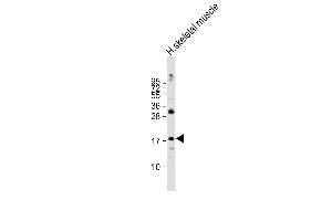 Anti-ND4L Antibody (C-term) at 1:2000 dilution + human skeletal muscle lysate Lysates/proteins at 20 μg per lane. (MT-ND4L 抗体  (C-Term))