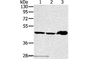 Western blot analysis of Mouse liver tissue and PC3 cell, human fetal liver tissue, using SEC14L2 Polyclonal Antibody at dilution of 1:400 (SEC14L2 抗体)