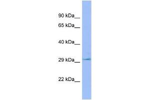 WB Suggested Anti-Lhpp Antibody Titration: 1. (LHPP 抗体  (C-Term))