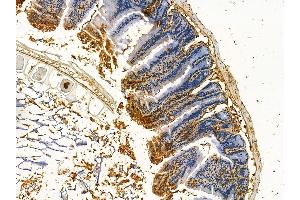 anti-BEN Domain Containing 5 (BEND5) antibody