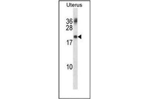 Western blot analysis of PMP22 Antibody  in Human normal Uterus cell line lysates (35ug/lane). (PMP22 抗体)