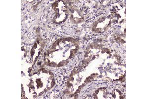 IHC analysis of GLO1 using anti-GLO1 antibody . (GLO1 抗体  (AA 2-184))