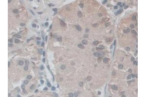 IHC-P analysis of Human Stomach Tissue, with DAB staining. (NOX5 抗体  (AA 456-765))