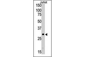 Western blot analysis of SIRT5 polyclonal antibody  in Jurkat cell lysate (35 ug/lane). (SIRT5 抗体  (C-Term))