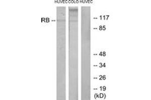 Western blot analysis of extracts from HuvEc/COLO cells, using Retinoblastoma (Ab-795) Antibody. (Retinoblastoma Protein (Rb) 抗体  (AA 761-810))