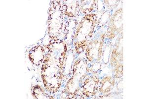 Immunohistochemistry of paraffin-embedded mouse kidney using GLUD1 Rabbit mAb (ABIN7267411) at dilution of 1:100 (40x lens). (GLUD1 抗体)