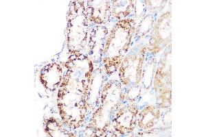 Immunohistochemistry of paraffin-embedded mouse kidney using GLUD1 Rabbit mAb (ABIN7267411) at dilution of 1:100 (40x lens). (GLUD1 抗体)