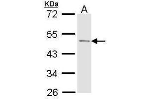 WB Image Sample (30 ug of whole cell lysate) A: Molt-4 , 10% SDS PAGE antibody diluted at 1:1000 (ACPP 抗体)