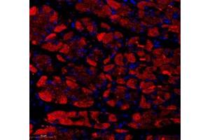 Immunofluorescence of paraffin embedded human stomach using KCTD19 (ABIN7075147) at dilution of 1: 500 (300x lens) (KCTD19 抗体)