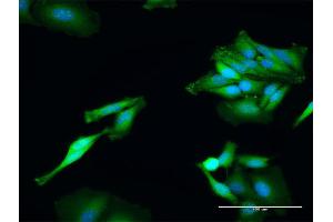 Immunofluorescence of purified MaxPab antibody to TXNRD1 on HeLa cell. (TXNRD1 抗体  (AA 1-497))