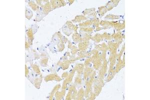 Immunohistochemistry (IHC) image for anti-N-Acetyltransferase 2 (Arylamine N-Acetyltransferase) (NAT2) (AA 171-290) antibody (ABIN6144378)